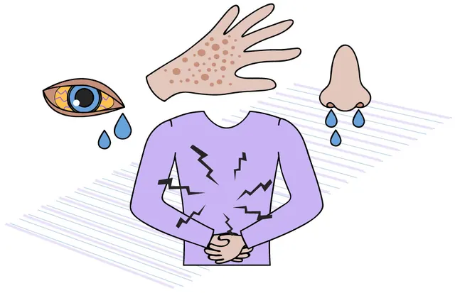 Härdplastutbildning för Ögonfrans- och nagelterapeuter